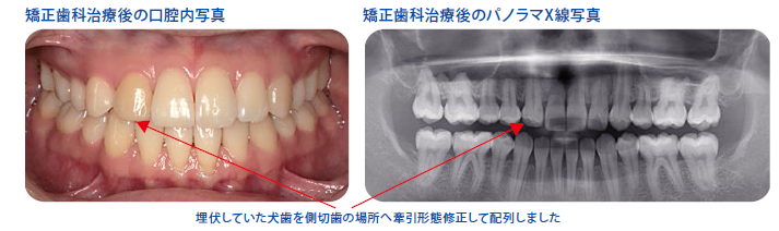 tokizane1512-05